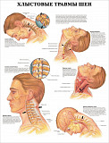 Травмы и болезни организма. Плакаты для медицинского колледжа